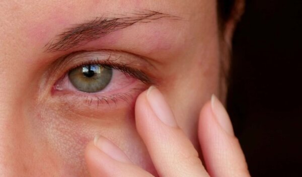 Красные глаза после сна в линзах